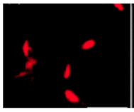 PYK10 | Beta-Galactosidase (internal) (ER marker, immunolocalisation) in the group Antibodies Plant/Algal / Membrane Transport System / Endomembrane system at Agrisera AB (Antibodies for research) (AS20 4409)